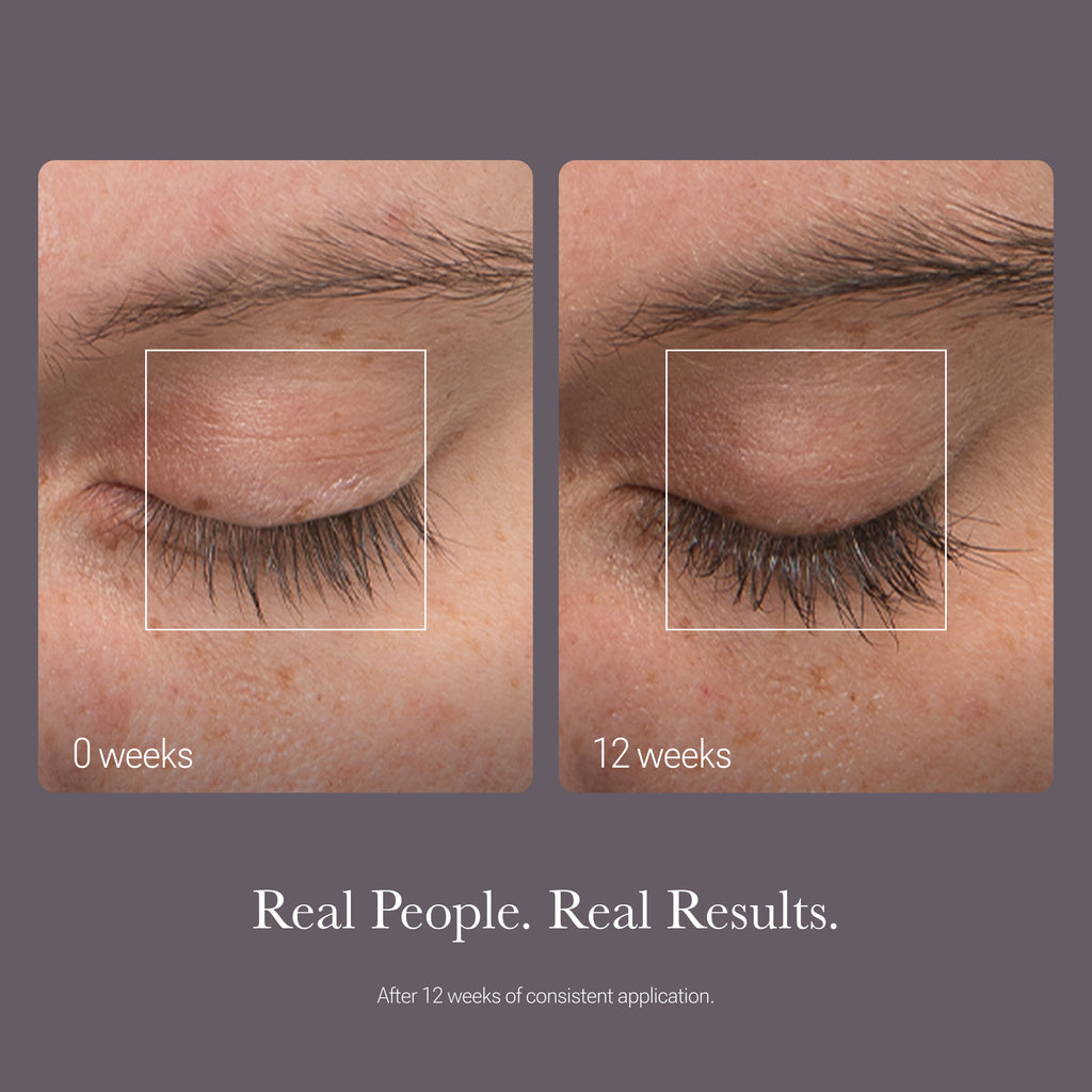 20X Eyelash Serum
